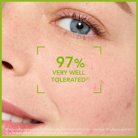 Bioderma Sébium Kerato + Anti-Blemish Gel Cream for Acne Prone Skin 30ml