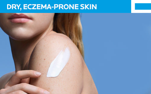 Dry, Excema Prone Skin