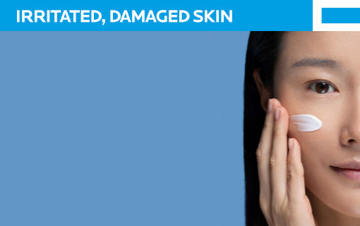 Irritated Damaged Skin