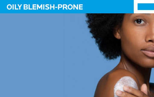 Oily Blemish Prone